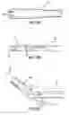 Fig. 06 - ARTICULATING SUTURING AND DEVICE AND METHOD