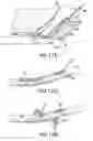 Fig. 12 - ARTICULATING SUTURING AND DEVICE AND METHOD