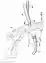 Fig. 25 - ARTICULATING SUTURING AND DEVICE AND METHOD