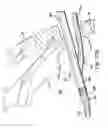 Fig. 26 - ARTICULATING SUTURING AND DEVICE AND METHOD