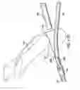 Fig. 28 - ARTICULATING SUTURING AND DEVICE AND METHOD