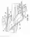 Fig. 29 - ARTICULATING SUTURING AND DEVICE AND METHOD