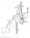 Fig. 31 - ARTICULATING SUTURING AND DEVICE AND METHOD