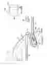 Fig. 33 - ARTICULATING SUTURING AND DEVICE AND METHOD