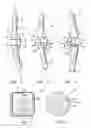 Fig. 02 - Composite vertebral rod system and methods of use