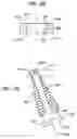 Fig. 23 - Orthopaedic surgical components