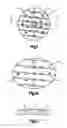 Fig. 02 - Plastic Implant for Osteosynthesis