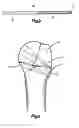 Fig. 03 - Plastic Implant for Osteosynthesis