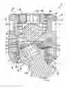 Fig. 01 - Multi-axial bone screw assembly