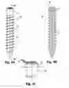 Fig. 04 - Multi-axial bone screw assembly