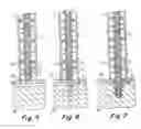 Fig. 04 - Method and apparatus for surgical fastening