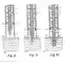 Fig. 05 - Method and apparatus for surgical fastening