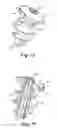 Fig. 07 - Method and apparatus for surgical fastening