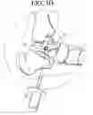 Fig. 05 - Porous expansion bolt