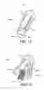 Fig. 12 - Porous expansion bolt