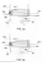 Fig. 04 - System and method for installing an annular repair rivet through a vertebral body port