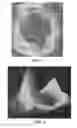 Fig. 05 - Surgical tools for arthroplasty