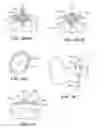 Fig. 18 - Surgical tools for arthroplasty