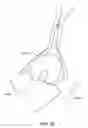Fig. 56 - Surgical tools for arthroplasty