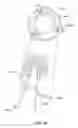 Fig. 57 - Surgical tools for arthroplasty