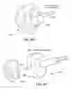 Fig. 60 - Surgical tools for arthroplasty