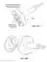 Fig. 61 - Surgical tools for arthroplasty