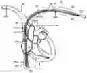 Fig. 01 - INTRAVASCULAR IMPLANTABLE DEVICE HAVING SUPERIOR ANCHORING ARRANGEMENT