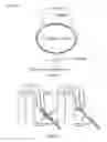 Fig. 02 - SACRAL NEUROSTIMULATION TO INDUCE MICTURITION IN PARAPLEGICS