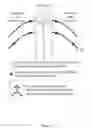Fig. 03 - SACRAL NEUROSTIMULATION TO INDUCE MICTURITION IN PARAPLEGICS