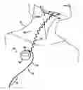 Fig. 01 - Obstructive Sleep Apnea Treatment Devices, Systems and Methods