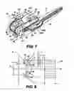 Fig. 06 - Obstructive Sleep Apnea Treatment Devices, Systems and Methods