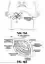 Fig. 09 - Obstructive Sleep Apnea Treatment Devices, Systems and Methods