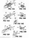 Fig. 11 - Obstructive Sleep Apnea Treatment Devices, Systems and Methods