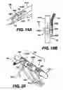 Fig. 13 - Obstructive Sleep Apnea Treatment Devices, Systems and Methods