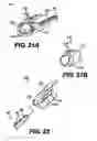 Fig. 14 - Obstructive Sleep Apnea Treatment Devices, Systems and Methods
