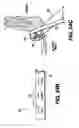 Fig. 18 - Obstructive Sleep Apnea Treatment Devices, Systems and Methods