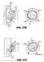 Fig. 22 - Obstructive Sleep Apnea Treatment Devices, Systems and Methods