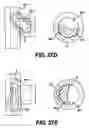 Fig. 23 - Obstructive Sleep Apnea Treatment Devices, Systems and Methods