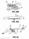 Fig. 27 - Obstructive Sleep Apnea Treatment Devices, Systems and Methods