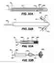 Fig. 29 - Obstructive Sleep Apnea Treatment Devices, Systems and Methods
