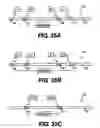 Fig. 31 - Obstructive Sleep Apnea Treatment Devices, Systems and Methods