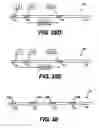 Fig. 32 - Obstructive Sleep Apnea Treatment Devices, Systems and Methods