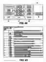 Fig. 41 - Obstructive Sleep Apnea Treatment Devices, Systems and Methods