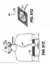 Fig. 44 - Obstructive Sleep Apnea Treatment Devices, Systems and Methods