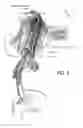 Fig. 03 - Methods and apparatus for treating anaphylaxis using electrical modulation