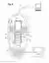 Fig. 04 - KEYBOARD WITH INTEGRATED ELECTROMAGNETIC RADIATION THERAPY