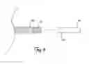 Fig. 07 - CARDIAC LEAD WELDING