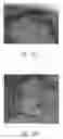 Fig. 31 - ANTI-ANGIOGENIC COMPOSITIONS AND METHODS OF USE