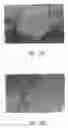 Fig. 32 - ANTI-ANGIOGENIC COMPOSITIONS AND METHODS OF USE