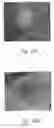 Fig. 34 - ANTI-ANGIOGENIC COMPOSITIONS AND METHODS OF USE